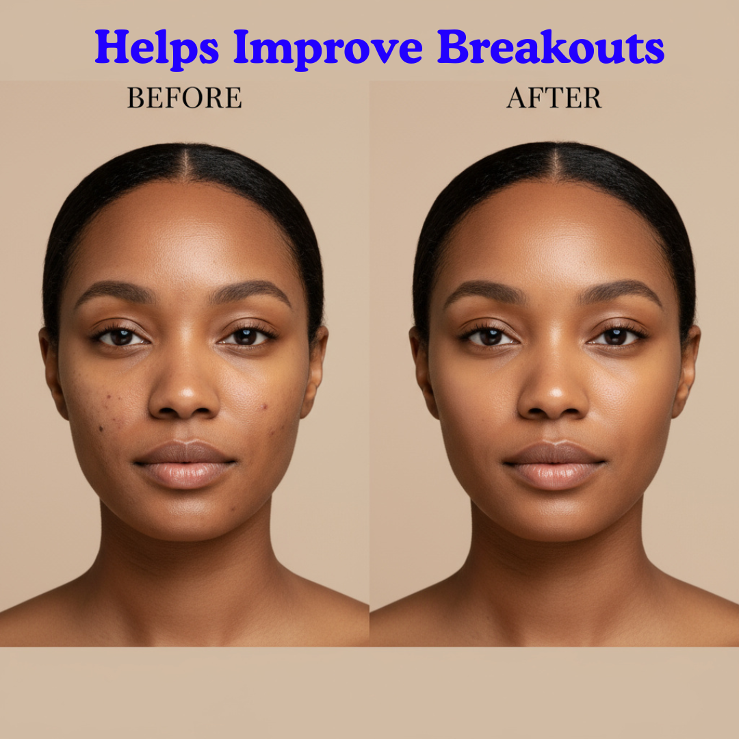 ClearSkin™ - Max Detox