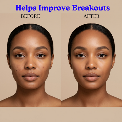 ClearSkin™ - Max Detox