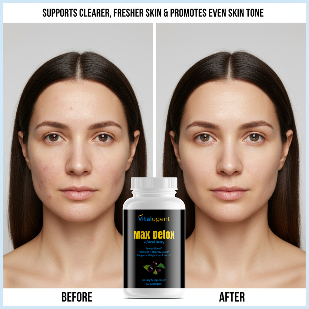 ClearSkin™ - Max Detox