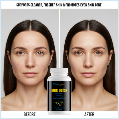 ClearSkin™ - Max Detox